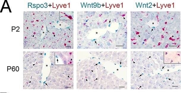 Lack of Wnt ligand secretion from LSECs impairs adult zonation maintenance.(A) Double in situ hybridization for Rspo3 (green), Wnt9b (green)&Wnt2 (green) showing a few LSCEs (Lyve1+, red) expressing those transcripts (blue arrows&inset) in P2 livers. Only Wnt2 transcripts are detected in some LSECs (inset) in P60 livers. Arrows indicate central vein endothelial cells&arrowheads indicate LSECs. Scale bars: 25 μm. Each image is representative of 3 individual mice (n = 3). Image collected & cropped by CiteAb from the following open publication (//pubmed.ncbi.nlm.nih.gov/32154783), licensed under a CC-BY license. Not internally tested by R&D Systems.