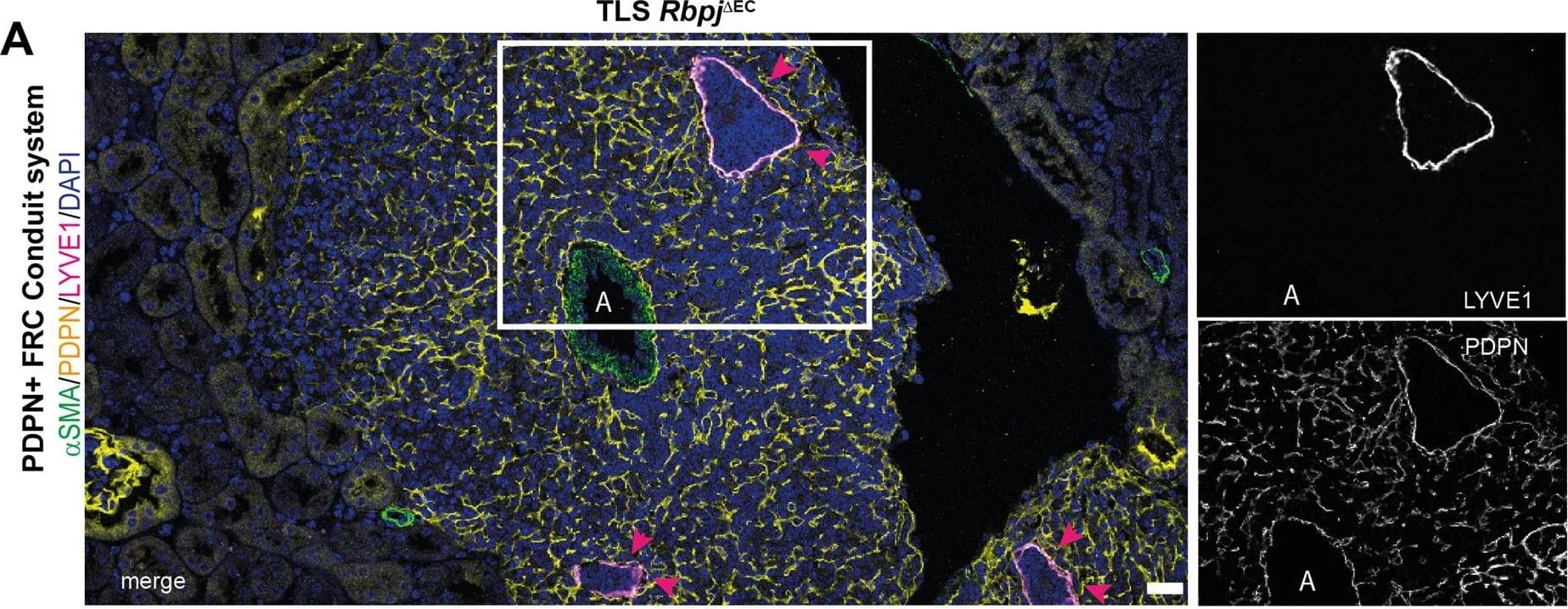 Molecular, cellular and structural composition of periarterial TLS.A–I Immunofluorescence staining and confocal laser scanning microscopy of representative Rbpj delta EC kidney samples, merged and single channels as indicated. “A” indicates artery. Optical Magnification 200x; different scan areas (see scale bars). Scale: solid bar 50 µm, dotted bar 10 µm (2E). Each micrograph is representative of at least 4 biological replicates. J Whole kidney mRNA expression, relative fold change to control gene Rps9, n = 10/group. Graphs: Scatter dot blot, mean, SD (whiskers). Mann–Whitney test, two-tailed, Exact p-values: Cxcl13, p = 0.0003; Cxcl12, p = 0.393; Cxcr5, p = 0.0433; Cxcr4, p = 0.0288; Ccl19, p = 0.0052; Baff, p = 0.0007; Rankl, p = 0.0005. Source data are provided as a Source Data file. Image collected and cropped by CiteAb from the following open publication (//pubmed.ncbi.nlm.nih.gov/35440634), licensed under a CC-BY license. Not internally tested by R&D Systems.