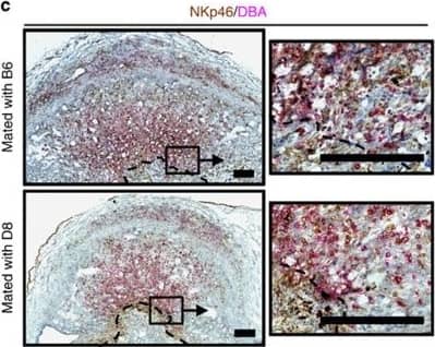 Paternal MHC expression on trophoblast.(a) Expression of paternal H-2Dd on gd9.5 trophoblast from B6 females impregnated by either B6 (top), D8 (middle) or BALB/c (bottom) males. BALB/c mice endogenously express H-2Dd. (b) H-2Dd and cytokeratin staining on control spleen cells. Scale bar=25 μm. (c) Representative sections of the distribution of NKp46+ DBA−(brown) and NKp46+ DBA+ (pink) uNK in the region of trophoblast invasion in the central decidua at gd9.5. Dashed lines demarcate the approximate boundary between invasive ectoplacental cone trophoblast and maternal decidua basalis. Scale bar=250 μm. DBA, Dolichos biflorus agglutinin. Image collected and cropped by CiteAb from the following publication (//www.nature.com/articles/ncomms4359), licensed under a CC-BY license. Not internally tested by R&D Systems.