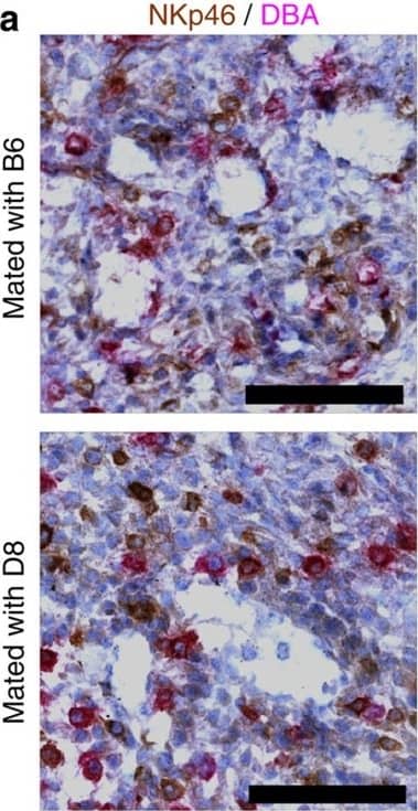 Paternal H-2Dd expression on trophoblast results in impaired arterial remodelling.(a) Immunohistochemical staining for NKp46 and DBA reveals abundant uNK around decidual vessels, independent of paternal MHC. Scale bar=100 μm. DBA, Dolichos biflorus agglutinin. (b) H&E staining of uterine arteries illustrating the strategy used to measure vessel size (yellow dashed ring) and relative thickness (surface area ratio between areas surrounded by yellow and black ring, red arrows). Scale bar=25 μm. (c–e) Stereological and immunohistochemical analysis of arterial size (c) and relative thickness (d) in the decidua of B6 females mated with either B6 or D8 males. Pooled data from 4 litters per cross, n=13–15 implantation sites. P-values from unpaired Student’s t-tests. Means±s.e.m. (e) Representative staining for smooth muscle actin showing that the characteristic loss of actin in the media of spiral arteries is reduced in matings with D8 males (black arrows). Scale bars=100 μm. Image collected and cropped by CiteAb from the following publication (//www.nature.com/articles/ncomms4359), licensed under a CC-BY license. Not internally tested by R&D Systems.