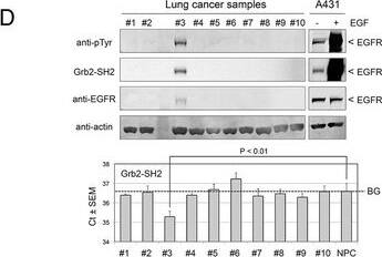 Applications of SH2-PLA assay. d, Application of SH2-PLA for cancer tissue analysis. The SH2-PLA/Western/far-Western analyses were performed using 10 lung cancer tissue samples. Upper panel shows Western and far-Western results with antibody/probe names indicated on the left. Only one sample (#3) shows an EGFR size band which also overlapped with bands detected by anti-pTyr and Grb2 SH2 (far-Western image represents 60-min exposure). The tyrosine phosphorylation level of the band is similar to the weak phosphorylation of EGFR in unstimulated A431 cells (right panel). The PLA-SH2 results for the same set of lung cancer samples are shown on the bottom. Consistent with the Grb2 far-Western result, only sample #3 had significant signal beyond the no protein control (NPC). The BG line indicates the background Ct value Image collected and cropped by CiteAb from the following open publication (//pubmed.ncbi.nlm.nih.gov/26112401), licensed under a CC-BY license. Not internally tested by R&D Systems.