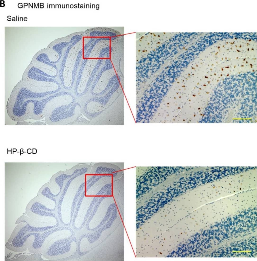 Intracerebroventricular treatment with 2-hydroxypropyl-beta -cyclodextrin (HP-beta -CD) attenuated the abnormal increase of glycoprotein nonmetastatic melanoma protein B (GPNMB) expression in Npc1−/− mice. Assays of GPNMB levels in brain using ELISA (A) and immunohistochemical staining of GPNMB (B) were performed. Scale bar: 100 μm. Data are presented as the mean ± S.E. (n = 4–7). *** p < 0.01 compared with the wild-type group. ### p < 0.001 compared with the saline group. Image collected and cropped by CiteAb from the following open publication (//pubmed.ncbi.nlm.nih.gov/33466390), licensed under a CC-BY license. Not internally tested by R&D Systems.