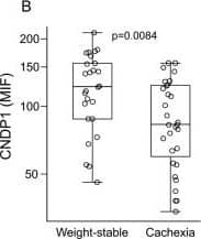 Identification and validation of CNPD1 reduction in CC.Detected protein levels are shown for A. the screen using Sandwich Bead Arrays (SBA) and B. validation by Sandwich Immunoassays (SIA) and expressed as mean intensity fluorescence (MIF). C. There was an excellent correlation between results obtained by SBA and SIA. CNPD1 levels measured by SIA were not influenced by D. age or E. gender. F. Distribution of circulating CNDP1 concentrations determined by SIA in Cohort 2. WS = Weight stable, CC = Cancer cachexia. P- and rho-values are given. Image collected and cropped by CiteAb from the following publication (//dx.plos.org/10.1371/journal.pone.0123566), licensed under a CC-BY license. Not internally tested by R&D Systems.