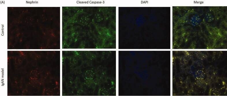 Colocalization of nephrin and cleaved caspase-3 in podocyte apoptosis in IgAN mice. (A) Double immunofluorescence was used to determine the expression of nephrin and cleaved caspase-3 in podocytes (magnification, x400). (B) Double immunofluorescence flux rate. Data are expressed as mean ± SD. *p < 0.05, **p < 0.01 vs. control group. IgAN, IgA nephropathy. Image collected and cropped by CiteAb from the following open publication (//pubmed.ncbi.nlm.nih.gov/35837694), licensed under a CC-BY license. Not internally tested by R&D Systems.