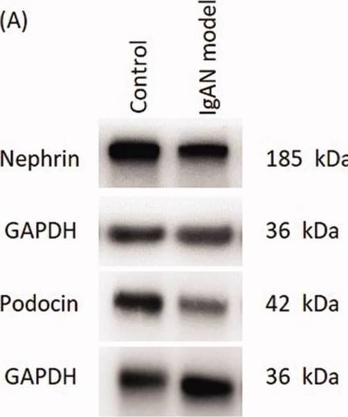 Proteins and mRNA expressions of podocin and nephrin are significantly reduced in IgAN mouse kidneys. (A) Western blotting results and (B) relative protein expression of nephrin and podocin. (C) Transcription levels of nephrin and podocin (n = 3). Data are expressed as mean ± SD. *p < 0.05, **p < 0.01 vs. control group. IgAN, IgA nephropathy. Image collected and cropped by CiteAb from the following open publication (//pubmed.ncbi.nlm.nih.gov/35837694), licensed under a CC-BY license. Not internally tested by R&D Systems.