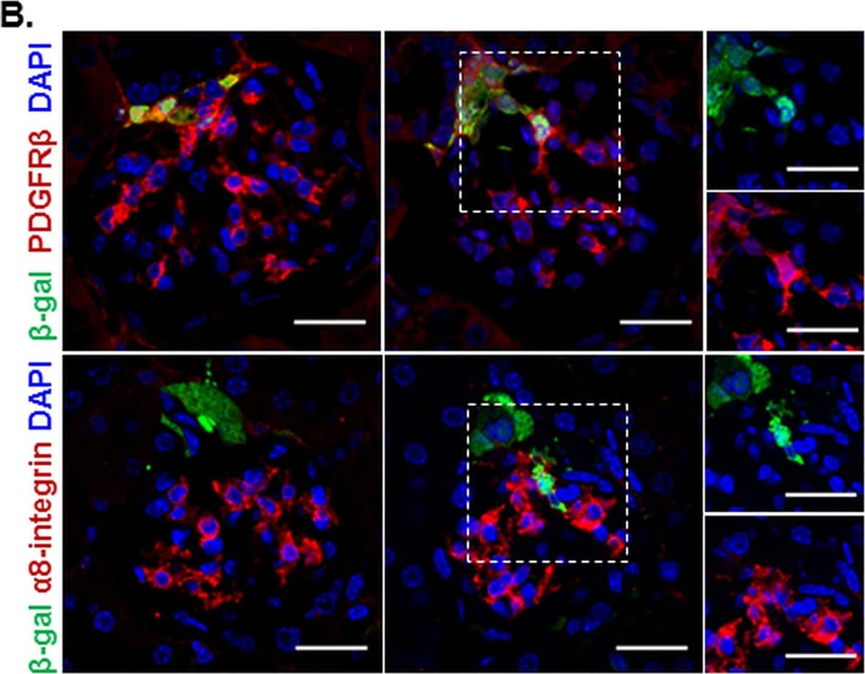 RLCs selectively differentiate to intraglomerular mesangial cells during EC model.A. Representative confocal microscopy images for day 0 and day 7 of  beta -gal and the EC markers ERG (upper panels) or CD31 (lower panels) co-stained kidney slices; B. Representative confocal microscopy images for day 0 and day 7 of  beta -gal and the mesangial cell markers PDGF beta R (upper panels) or  alpha 8-integrin (lower panels) co-stained kidney slices; C. Representative confocal microscopy images for day 0 and day 7 of  beta -gal/WT1 (podocyte marker) co-stained kidney slices. 4′,6-diamidino-2-phenylindole (DAPI) was used as a nuclear marker throughout. The channels for green ( beta -gal) and red (corresponding cell marker) fluorescent signals in the dashed squares on day 7 are separately shown in the small right panels. Scale bars correspond to 25 μm. Image collected and cropped by CiteAb from the following publication (//pubmed.ncbi.nlm.nih.gov/29771991), licensed under a CC-BY license. Not internally tested by R&D Systems.