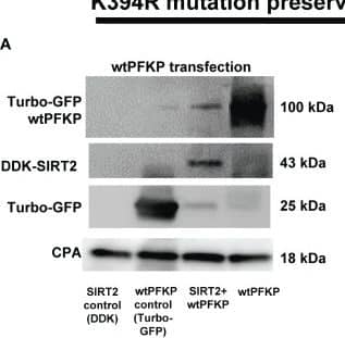 Effect of K394R mutation on PFKP. (A, B) HEK293T cells transfected with wtPFKP/mtPFKP in the presence or absence of SIRT2. Western blot analysis of Turbo-GFP-wtPFKP, DDK-SIRT2, turbo-GFP (control for wtPFKP plasmid transfected) and CPA. (C) mtPFKP transfection and IP using turbo-GFP-trap in HEK293T cells, in presence or absence of SIRT2 followed by IB analysis of acetyl lysine, turbo-GFP-mtPFKP and turbo-GFP (control for wtPFKP plasmid transfected). Pulldown with HEK293T cell lysate without transfection was used as a negative control. (D) Western blot analysis of turbo-GFP mtPFKP, DDK-SIRT2, turbo-GFP and CPA in whole cell lysate, used as an input for the turbo-GFP IP. (E) mtPFKP transfection and IP using magnetic-TUBEs in HEK293T cells, in presence or absence of SIRT2 followed by IB analysis of ubiquitination. (F) Western blot analysis of turbo-GFP mtPFKP, DDK-SIRT2, turbo-GFP and CPA in whole cell lysate used as input for the TUBE IP. Image collected and cropped by CiteAb from the following open publication (//pubmed.ncbi.nlm.nih.gov/36865524), licensed under a CC-BY license. Not internally tested by R&D Systems.