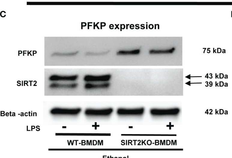 The effect of acute ethanol-exposure-induced SIRT2 on PFKP expression in macrophages. (A) PFKP expression in WT-BMDM exposed to vehicle or ethanol ± LPS by western blot analysis. (B) PFKP western blot image quantification of PFKP protein in vehicle vs. ethanol exposed WT-BMDM, Y axis represents fold of vehicle-LPS (fold of vehicle control) (n = 4 blots; * p < 0.05). (C) PFKP expression in Ethanol-exposed WT-BMDM and SIRT2KO-BMDM ± LPS. (D) Western blot image quantification of PFKP protein in ethanol exposed WT-BMDM and SIRT2KO-BMDM. Y axis represents fold of Ethanol-exposed WT-LPS (fold of WT- ethanol control) (n = 4 blots; * p < 0.05). (E) PFKP expression in Ethanol-exposed WT-BMDM treated with AK-7 or DMSO ± LPS. (F) Western blot image quantification of PFKP in AK-7 vs. DMSO treated-Ethanol-exposed WT-BMDM ± LPS, Y axis represents fold of Ethanol-exposed WT-LPS (fold of WT- ethanol control) (n = 4 blots; * p < 0.05). Image collected and cropped by CiteAb from the following open publication (//pubmed.ncbi.nlm.nih.gov/36865524), licensed under a CC-BY license. Not internally tested by R&D Systems.