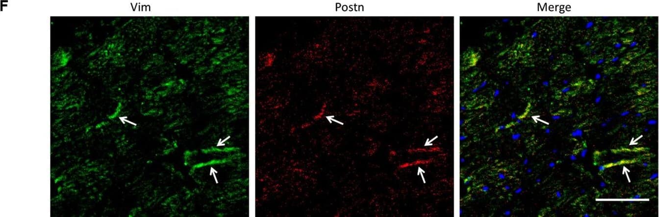 Analysis of the heterogeneity of the fibroblast subpopulations.(A) t-SNE plot of the 10 cardiac fibroblast subpopulations in the high-fat diet (HFD)/streptozotocin (STZ)-treated and control mice (n = 3428 fibroblasts from healthy control and n = 2988 fibroblasts from 6 diabetic mice). (B) Correlation heatmap of the gene-expression signatures of each fibroblast subpopulation. Color differences indicate subpopulations that were resolved through multiscale bootstrapping. (C) Heatmap showing the top 5 marker genes in each fibroblast subpopulation. The red color indicates high expression, while green color indicates low expression. (D) Heatmap showing the enriched Gene Ontology (GO) terms associated with cardiac fibrosis in each fibroblast population. (E, F) Representative immunofluorescence images of Hrc (E) and Postn (F) in mouse heart (n = 6 mice per group), scale bar = 100 µm. The details of the 10 transcriptionally distinct fibroblast subpopulations are listed in Supplementary file 15. The details of distinct signatures of each fibroblast subpopulation in the heart are listed in Supplementary file 16. Image collected and cropped by CiteAb from the following open publication (//pubmed.ncbi.nlm.nih.gov/37010266), licensed under a CC-BY license. Not internally tested by R&D Systems.