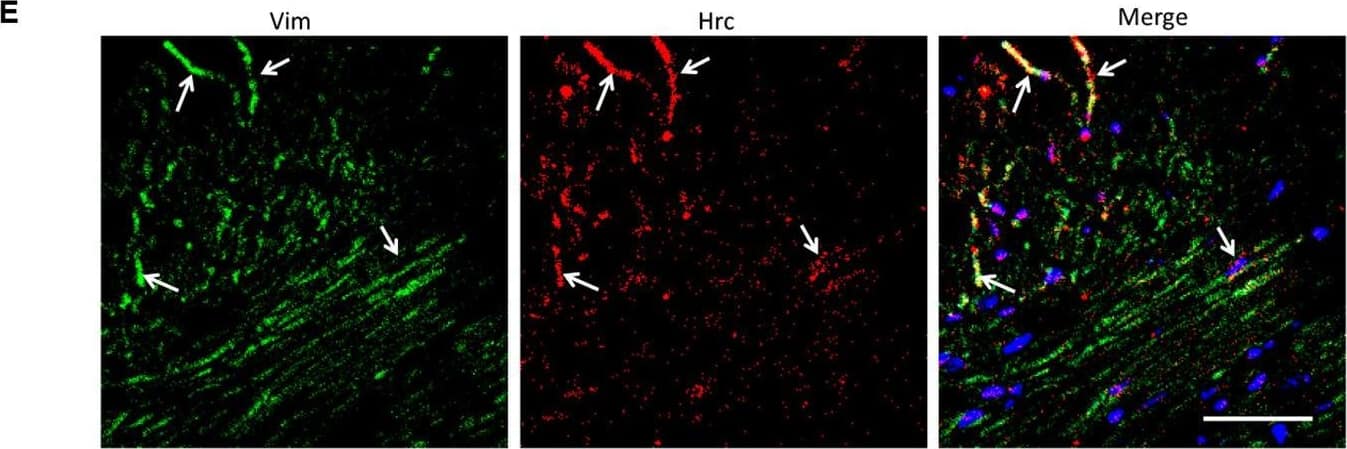 Analysis of the heterogeneity of the fibroblast subpopulations.(A) t-SNE plot of the 10 cardiac fibroblast subpopulations in the high-fat diet (HFD)/streptozotocin (STZ)-treated and control mice (n = 3428 fibroblasts from healthy control and n = 2988 fibroblasts from 6 diabetic mice). (B) Correlation heatmap of the gene-expression signatures of each fibroblast subpopulation. Color differences indicate subpopulations that were resolved through multiscale bootstrapping. (C) Heatmap showing the top 5 marker genes in each fibroblast subpopulation. The red color indicates high expression, while green color indicates low expression. (D) Heatmap showing the enriched Gene Ontology (GO) terms associated with cardiac fibrosis in each fibroblast population. (E, F) Representative immunofluorescence images of Hrc (E) and Postn (F) in mouse heart (n = 6 mice per group), scale bar = 100 µm. The details of the 10 transcriptionally distinct fibroblast subpopulations are listed in Supplementary file 15. The details of distinct signatures of each fibroblast subpopulation in the heart are listed in Supplementary file 16. Image collected and cropped by CiteAb from the following open publication (//pubmed.ncbi.nlm.nih.gov/37010266), licensed under a CC-BY license. Not internally tested by R&D Systems.
