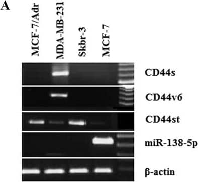 A-B Expression of CD44st, CD44s, CD44v6 mRNA and miR-138-5p in breast cancer cell lines. A Semi-quantitative PCR agarose electrophoresis plots of different cell lines B Quantitative PCR results of different cell lines Image collected and cropped by CiteAb from the following open publication (//pubmed.ncbi.nlm.nih.gov/36964570), licensed under a CC-BY license. Not internally tested by R&D Systems.