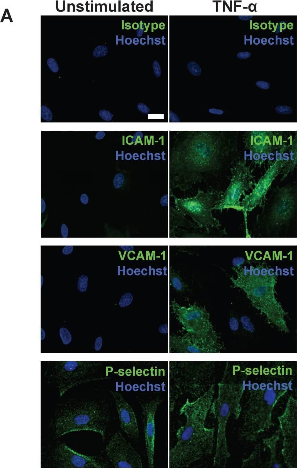  Following stimulation, coronary artery endothelial cells (CAEC) express adhesion molecules detectable via immuno-SERS imaging in single and multiplex formats. (A) Fluorescence images of immunohistochemical staining of ICAM-1, VCAM-1 and P-selectin on CAEC in unstimulated and 10 ng/mL TNF-alpha -stimulated conditions. Isotype control, ICAM-1, VCAM-1 and P-selectin staining shown in green; nuclei were counterstained using Hoechst 33342 (blue). (B) CAEC were stimulated with 10 ng/mL TNF-alpha  for 24 h, fixed in acetone, and incubated with isotype control, anti-ICAM-1, anti-VCAM-1 or anti-P-selectin BFNP or (C) with all BFNP simultaneously before being subjected to SERS mapping. (D) Representative spectra from anti-ICAM-1 (purple), anti-VCAM-1 (red) and anti-P-selectin (blue) BFNP acquired from the color-matched circles in (C) are shown above their respective reference spectra. Optical images in (B-C) are darkfield images. Scale bars = 20 μm. Results are representative of 3 independent experiments. Image collected and cropped by CiteAb from the following open publication (//pubmed.ncbi.nlm.nih.gov/30613292), licensed under a CC-BY license. Not internally tested by R&D Systems.