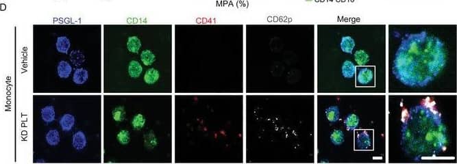 KD platelets crosstalk with monocytes via forming “adhesion junctions”. A) Flow cytometry analysis showing CD62p expression in platelets from HS (n = 24) and KD patients (n = 24). Unpaired t test. B) Correlation between MPA and CD62p positive platelets in patients with acute KD (n = 24). p value was calculated using correlation analysis. C) Heatmap showing selected ligand–receptor interactions between MPA and subtypes of monocytes. D) Immunostaining of PSGL‐1 (blue), CD14 (green), CD41 (red), and CD62p (gray) in monocytes after coculture with KD platelets for 8 h. Activated CD41+ platelets (red) forming CD62p (gray) and PSGL‐1‐mediated junctions (blue) with CD14+ monocytes (green) are shown (n = 6). Scale bar: 5 µm. E) Immunostaining of CD11b (blue), CD14 (green), CD41 (red), GPIb alpha  (gray) in monocytes after coculture with KD platelets for 8 h. Activated CD41+ platelets (red) forming GPIb alpha  (gray) and CD11b‐mediated junctions (blue) with CD14+ monocytes (green) are shown (n = 6). Scale bar: 5 µm. F,G) Proximity ligation assay (PLA) showing adhesion junctions of CD62p–PSGL‐1 (F), GPIb alpha –CD11b (G) on monocytes. PLA staining: red; nuclei: blue; wheat germ agglutinin (WGA): green (n = 5). Scale bar: 10 µm. PLT, platelet; HS, healthy subject; KD, Kawasaki disease; MPA, platelet–monocyte aggregate; ITGAM, integrin subunit alpha M (CD11b). Image collected and cropped by CiteAb from the following open publication (//pubmed.ncbi.nlm.nih.gov/39665236), licensed under a CC-BY license. Not internally tested by R&D Systems.