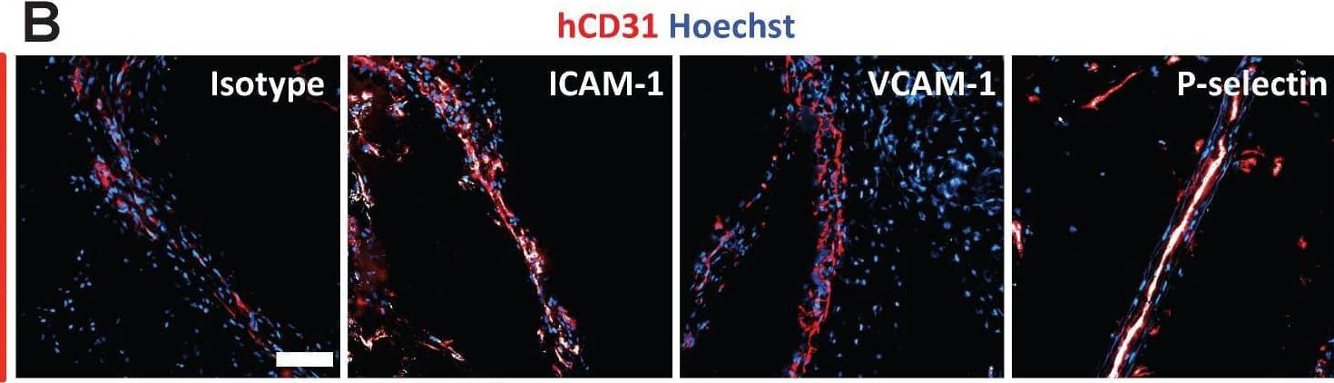 In vivo SERS-BFNP molecular imaging of adhesion molecules. Following engraftment of human adipose, HANSG mice were allowed to recover for 3 weeks. Mice were then injected intravenously with 5 μg of human recombinant TNF-alpha  4 h prior to receiving an intravenous injection of BFNP. (A) Following SERS-BFNP molecular imaging, adipose grafts were excised and immunofluorescently stained for human (red) and murine (green) CD31. (B) Isotype control, ICAM-1, VCAM-1, and P-selectin staining are also shown in white counterstained with human CD31 (red). Nuclei were counterstained using Hoechst 33342 (blue). (C) To conduct SERS-BFNP molecular imaging, HANSG mice were anaesthetized and their adipose grafts non-invasively analyzed in vivo using SERS spectroscopy. (D) SERS spectra were acquired from mice that received a mixture of isotype-PPY, -BPE and -PYOT (blue spectra), or anti-P-selectin-PPY, anti-ICAM-1-BPE, anti-VCAM-1-PYOT BFNP (red spectra). The spectra shown are from 5 isotype vs. 5 targeted mice, with each spectrum acquired from a different mouse. (E) In addition to immunofluorescence microscopy, excised adipose grafts were analyzed using SERS microscopy. Detection of BFNP from sections of adipose tissue isolated from HANSG mice that received anti-ICAM-1 (purple), anti-VCAM-1 (red), and anti-P-selectin (blue) (upper panels) or Isotype-BPE (purple), Isotype-PYOT (red), and Isotype-PPY (blue) (lower panels) are shown superimposed on darkfield tissue images alongside a magnified image of Raman maps from the scanned areas (black boxes). The colored circles in the Raman map ((E) upper panel) correlate to the acquired spectra shown in (F) above their respective reference spectra. The optical image in (E) is a darkfield image. Scale bars: (A) = 1000 μm; (B) = 100 μm; (E) = 20 μm. Image collected and cropped by CiteAb from the following open publication (//pubmed.ncbi.nlm.nih.gov/30613292), licensed under a CC-BY license. Not internally tested by R&D Systems.