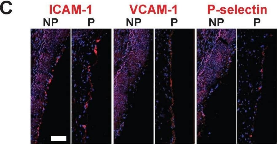  SERS-BFNP molecular imaging of atherosclerotic coronary arteries. A single human coronary artery was isolated from the heart of a patient undergoing heart transplantation surgery. The lumen of the artery segment was then injected with a mixture of anti-ICAM-1, anti-VCAM-1, anti-P-selectin, and isotype control BFNP, sutured closed, and incubated at 37 °C/5% CO2 for 12 h. Sutures were then removed and the artery segment was thoroughly washed prior to SERS spectroscopy and subsequent analysis of morphology, expression of adhesion molecules and SERS mapping. (B) Immunofluorescence staining for CD31, and expression of (C) ICAM-1, VCAM-1 and P-selectin are shown in red. Nuclei were counterstained using Hoechst 33342 (blue). Image collected and cropped by CiteAb from the following open publication (//pubmed.ncbi.nlm.nih.gov/30613292), licensed under a CC-BY license. Not internally tested by R&D Systems.