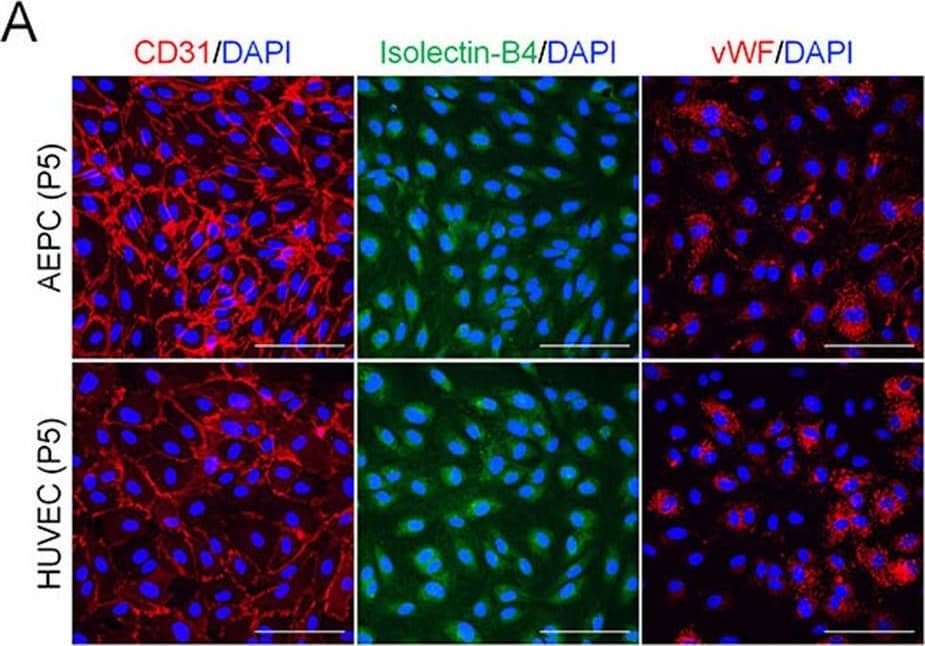 Characterization&functional analysis of expanded AEPCs compared with HUVECs. All the experiments performed using AEPCs&HUVECs at passage number 5. (A) Fluorescent immunocytochemistry of the expression profiles of endothelial cell-specific markers, CD31, vWF,&the binding capacity of isolectin-B4, in AEPCs&HUVECs. Nuclear staining was assessed by 4′,6-diamidino-2-phenylindole (DAPI). Photographs taken using a confocal microscope (OLYMPUS, FV1000 with a CCD camera DP71&an objective lens UPlanFL N 40×/1.30 oil; 400× magnification) as a plane image. Bars represent 100 µm. The graphs show the %age of endothelial marker-positive cells among DAPI-positive cells. The data represent two independent experiments (2 donors),&%ages determined from cultivations performed in triplicate. The bars represent means ± SD (n = 6, **P < 0.01, two-tailed unpaired t-test). Image collected & cropped by CiteAb from the following open publication (//pubmed.ncbi.nlm.nih.gov/35110646), licensed under a CC-BY license. Not internally tested by R&D Systems.