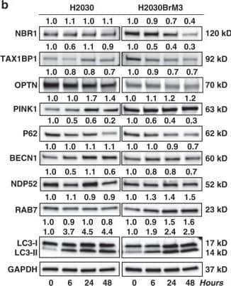 Western Blot: PINK1 Antibody - BSA Free [BC100-494] - Mito-LND modulates energetic & autophagy signaling proteins in vitro & in vivo. a Mito-LND (2 µM) modulates AMPK & AKT/mTOR signaling cascades in H2030 & H2030BrM3 lung cancer cell lines over time. b Mito-LND (2 µM) modulates autophagy & specific mitophagy-linked proteins in H2030 & H2030BrM3 lung cancer cells. c Mito-LND (2 µM) modulates autophagy & specific mitophagy-linked proteins in A549 & NCI-H460 lung cancer cells. d Mito-LND induces autophagy in lung tumor tissues in mouse orthotopic model of lung cancer. e Induction of autophagy by Mito-LND in brain tumor tissues in the mouse brain lung metastasis model. The relative band intensities as determined by densitometry are indicated above each blot Image collected & cropped by CiteAb from the following publication (//pubmed.ncbi.nlm.nih.gov/31101821), licensed under a CC-BY license. Not internally tested by Novus Biologicals.