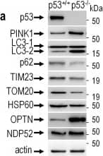Western Blot: PINK1 Antibody - BSA Free [BC100-494] - TP53 knockout triggers a pro-mitophagic response.PINK1 (a,b, N = 8), LC3-2/LC3-1 (a,c, N = 8), p62 (a,d, N = 12), TIM23 (a,e, N = 10), TOM20 (a,f, N = 9), HSP60 (a,g, N = 16), optineurin (a,h, N = 9) & NDP52 (a,i, N = 8) protein levels were analyzed in control (p53+/+) or TP53-deficient (p53−/−) HAP1 cells as described in the Methods. Bars represent the means ± SEM of 3-4 independent experiments performed in triplicate & are expressed as percent of control (p53+/+) cells. Actin expression is provided as a representative gel loading control in a. Statistical analyses were performed with GraphPad Prism software by using unpaired Student’s t-test. Significant differences are: ** p < 0.01, ***p < 0.001 & ****p < 0.0001. Image collected & cropped by CiteAb from the following publication (//pubmed.ncbi.nlm.nih.gov/29352272), licensed under a CC-BY license. Not internally tested by Novus Biologicals.