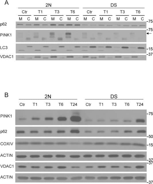 Western Blot: PINK1 Antibody - BSA Free [BC100-494] - Impairment of mitophagy upon Antimycin A & Oligomycin exposure.a Cells were treated with Antimycin A (1 μM) & Oligomycin (1 μM) for 1, 3, & 6 & mitochondrion/cytosol fractionation was performed to assay the accumulation of LC3-II, p62 & PINK1 within the mitochondrial fraction. VDAC1 was used as a loading control for mitochondrial fractions. b, c Cells were treated with Antimycin A (1 μM) & Oligomycin (1 μM) for 1, 3, 6, & 24 h & total fibroblasts extracts were analyzed for PINK1, p62, COXIV & VDAC1. Each quantitative data was normalized with ACTIN (n ≥ 3). Statistical analysis was performed using two-way ANOVA with Tukey’s multiple comparisons test. (*p < 0.05; **p < 0.01; ***p < 0.001). Immunoblots reported are from one representative experiment Image collected & cropped by CiteAb from the following publication (//pubmed.ncbi.nlm.nih.gov/31332166), licensed under a CC-BY license. Not internally tested by Novus Biologicals.