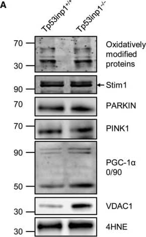 Western Blot: PINK1 Antibody - BSA Free [BC100-494] - Protein content & oxidation. Gastrocnemius muscle was analyzed by immunoblotting (A) for oxidatively modified protein, STIM1, PARKIN, PINK1, PGC‐1 alpha , VDAC1, & 4HNE (B). Data are means ± SEM. *Significantly different from Tp53inp1+/+. Image collected & cropped by CiteAb from the following publication (//pubmed.ncbi.nlm.nih.gov/31124296), licensed under a CC-BY license. Not internally tested by Novus Biologicals.