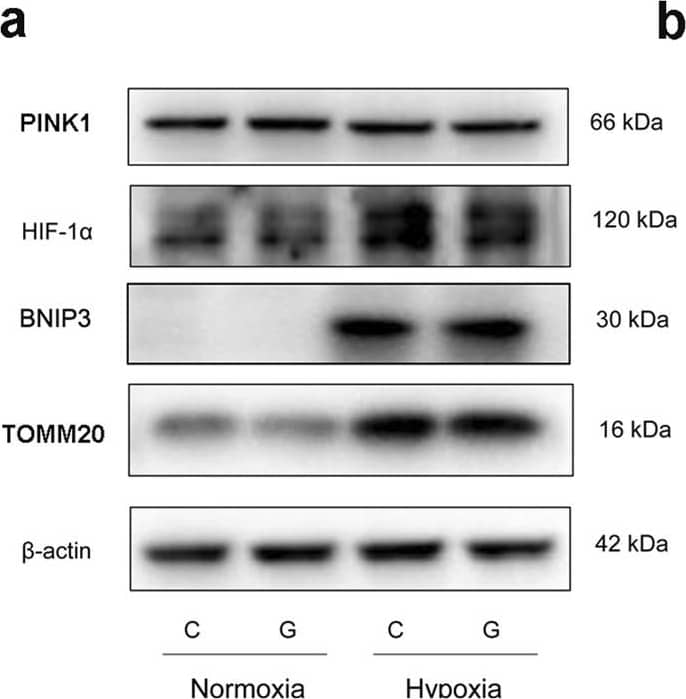Western Blot: PINK1 Antibody - BSA Free [BC100-494] - The HIF-1 alpha -BNIP3 pathway was activated during hypoxia. (a) Analysis of mitophagy-related protein expression in Neuro-2a cells by immunoblotting. Neuro-2a cells were exposed to hypoxia and/or high glucose for 48 h. Total cellular extracts were analysed by immunoblotting with antibodies against HIF-1 alpha , BNIP3, PINK1 & TOMM20. (b) The ImageJ densitometric analysis is shown. “C” represented control conditions (25 mM glucose), “G” represented high glucose conditions (75 mM glucose). The results are expressed as the mean ± SEM from three independent experiments. Two-way ANOVA, **p < 0.01, *p < 0.05, Hypoxia vs Normoxia. Full-length blots are presented in Supplementary Fig. S2. Image collected & cropped by CiteAb from the following publication (//www.nature.com/articles/s41598-018-20162-1), licensed under a CC-BY license. Not internally tested by Novus Biologicals.