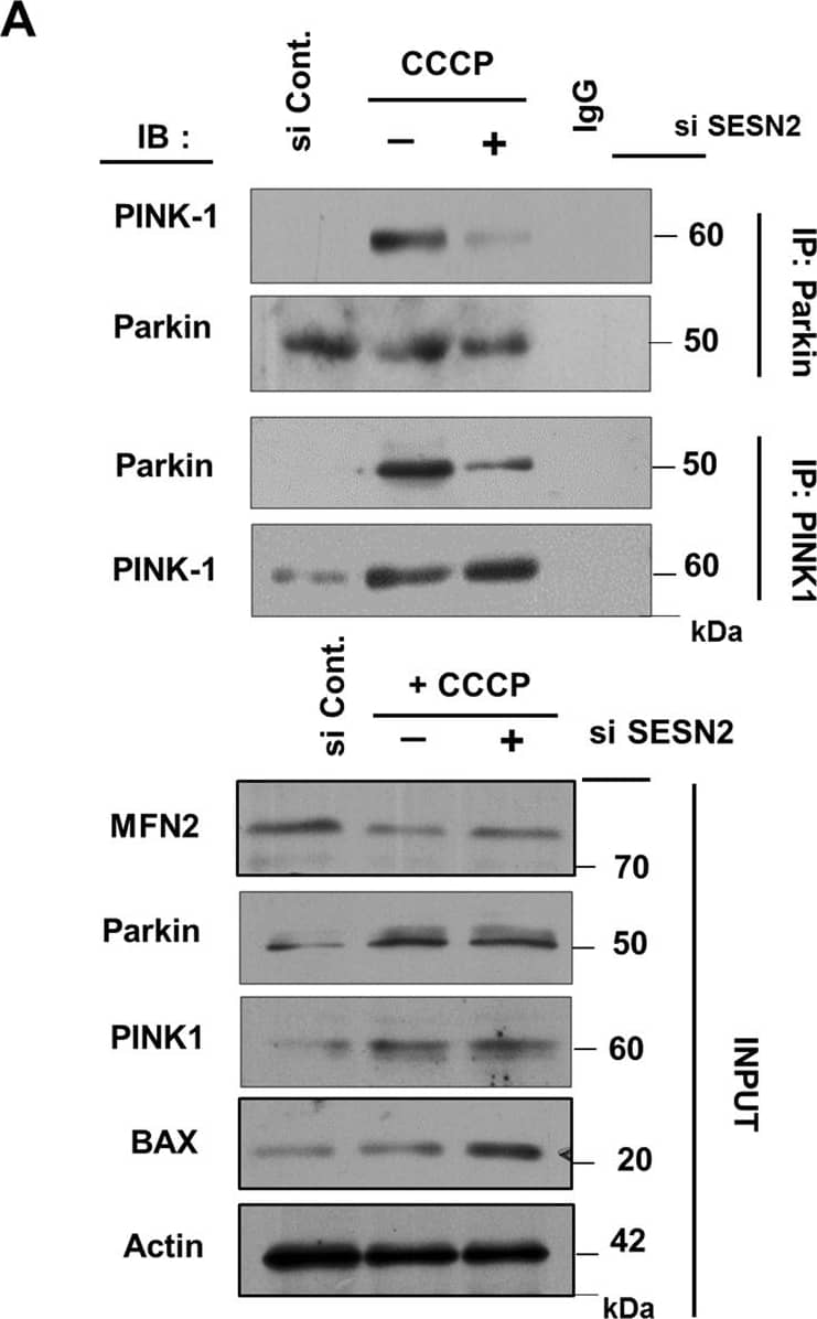 Western Blot: PINK1 Antibody - BSA Free [BC100-494] - PINK1 is required for Parkin translocation but interaction between Beclin1 & Parkin is PINK1 independent. (A) HEK293T cells were transfected with scrambled siRNA & siRNA targeting SESN2 followed by treatment with 10 µM CCCP for 3 h. Total cell lysates were co-immunoprecipitated using anti-PINK1 & anti-Parkin antibodies, to find the variation in interaction between endogenous PINK1 & Parkin. Interaction of PINK1 with Parkin is less prominent on downregulation of SESN2. (B) Effect of PINK1 on mitochondrial translocation of Parkin was assessed by transfecting cells with scrambled siRNA & PINK1 siRNA followed by treatment with 10 µM CCCP for 3 h. Cellular sub-fractionation was done & mitochondrial fraction was subjected to immunoblotting. TOMM20, mitochondrial marker. 1-DMSO, 2-CCCP. Note that PINK1 knockdown abolishes the presence of Parkin. (C) To check the mitochondrial stabilization of PINK1 in SESN2 knockdown cells, cells were treated with DMSO (vehicle) & CCCP for 3 h & western blot analysis was carried out in isolated mitochondrial fractions. VDAC1, mitochondrial marker & TUBB/ beta -Tubulin, cytosolic marker. Levels of SESN2 in PINK1 knockdown cells were analysed with western blots in whole cell lysates. 1-DMSO, 2-CCCP. Note: downregulation of SESN2 or PINK1 was unable to decline stability of each other. (D) Wild-type (WT) & PINK1 knockdown cells were treated with DMSO (vehicle) & CCCP for 3 h. Cytosolic fractions were isolated & subjected to co-IP assay using anti-Beclin1 & anti-Parkin antibodies. Immunoblots were converted to gray & white scale using Adobe Photoshop CS6, with linear adjustment of exposure or contrast. Images of immunoblots were cropped for clarity, expanded view of Fig. 6D is available in supplementary figures. Image collected & cropped by CiteAb from the following publication (//pubmed.ncbi.nlm.nih.gov/29330382), licensed under a CC-BY license. Not internally tested by Novus Biologicals.