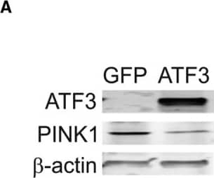 Western Blot: PINK1 Antibody - BSA Free [BC100-494] - Inactivation of ATF3 potentiates PINK1 transcription. (a) Representative immunoblot analysis of ATF3 & PINK1 in total cell lysates of A549 cells, transfected with GFP (transfection control) or ATF3. Cells overexpressing ATF3 for 48 hr show lower levels of PINK1 in whole cell lysates. A549 cells transfected with siRNA scramble control or ATF3 siRNA for a total of 48 hr & exposed to tunicamycin the last 24 hr (b–d). Less ATF3 mRNA after 24 hr TM treatment (b) & a recovery of the basal PINK1 transcript levels (c) were measured in knockdown ATF3 cells. (d) At 48 hr, protein levels of ATF3 also reflect these changes after TM treatment in the presence or absence of ATF3 silencing (see Figure S2F). Data represent mean ± SEM of four (a–c) & three (d) independent experiments. *p < .01, two‐way ANOVA with multiple comparison test Image collected & cropped by CiteAb from the following publication (//pubmed.ncbi.nlm.nih.gov/29363258), licensed under a CC-BY license. Not internally tested by Novus Biologicals.