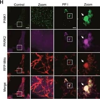 Immunocytochemistry/ Immunofluorescence: PINK1 Antibody - BSA Free [BC100-494] - Polyphyllin I triggers PINK1/PARK2-dependent mitophagyA. MDA-MB-231 cells treated w/ 8 μM PPI for different periods of time as indicated, & PARK2, P62, & ubiquitin (UB) levels in mitochondrial fractions determined by western blot. B. Cells cotransfected w/ GFP-UB & RFP-mito & treated w/ 8 μM PPI for 9 h, after which PARK2 (Alexa Fluor 405, pink) & P62 (Alexa Fluor 647, blue) immunostaining detected using confocal microscopy. C. Cells cotransfected w/ GFP-UB & RFP-LC3 treated w/ 8 μM PPI for 9 h, after which PARK2 (Alexa Fluor 405, pink) & TOMM20 (Alexa Fluor 647, blue) immunostaining detected using confocal microscopy. Scale bars: 10 μm. D-E. MDA-MB-231 cells treated w/ 8 μM PPI for different periods of time as indicated; whole-cell lysates then separated on 8% SDS-PAGE gels & analyzed by western blot using the anti-PINK1 antibody. Relative full-length (∼63 kDa) & cleaved (∼52 kDa) PINK1 levels quantified by densitometry & normalized to Tubulin. Results expressed as a percentage of control, which set at 100%. Data are presented as mean ± SD (*P< 0.01 vs. the control). F. Cells treated w/ 8 μM PPI for different periods of time as indicated, & whole-cell lysates then subjected to western blot analysis. G. Cells treated w/ 8 μM PPI for 9 h, after which mitochondrial fractions prepared & subjected to immunoprecipitation using anti-PINK1 antibody; associated PARK2 detected using immunoblotting. H. RFP-mito-expressing MDA-MB-231 cells treated w/ 8 μM PPI for 9 h, & PINK1 (Alexa Fluor 488, green) & PARK2 (Alexa Fluor 405, pink) immunostaining evaluated using confocal microscopy. Scale bars: 10 μm. Image collected & cropped by CiteAb from the following publication (//www.oncotarget.com/lookup/doi/10.18632/oncotarget.14413), licensed under a CC-BY license. Not internally tested by Novus Biologicals.