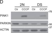Western Blot: PINK1 Antibody - BSA Free [BC100-494] - Alteration of PARKIN leads to an impairment of mitophagy upon CCCP treatment.a 2 N & DS treated w/ CCCP (20 μM) for 6 h & mitochondrion/cytosol fractionation performed to assay the accumulation of LC3-II & p62 w/in mitochondrial fraction. VDAC1 & ACTIN used as a loading control for mitochondrial & cytosolic fractions, respectively. b, c Quantitative data of LC3-II & p62 in mitochondrial fraction normalized w/ VDAC1 (n = 3). d The cells treated w/ CCCP (20 μM) for 6 h & the whole-cell extracts from 2 N & DS analyzed by WB for PARKIN & PINK1. e Quantification of PARKIN normalized w/ ACTIN (n ≥ 3). d Quantification of PINK1 after 6 h of CCCP, each quantitative data normalized w/ ACTIN (n ≥ 3). g Representative confocal images of cells stained w/ Mitotracker green (mitochondrial marker) & Lysotracker red (lysosomal marker) upon CCCP treatment (20 μM for 6 h). White arrow heads point to co-localization w/in puncta from boxed region at high magnification shown on the right. Scale bar 10 μm. h The graph the % of Mitotracker green /Lysotracker red colocalization calculated by JACoP plugin of ImageJ. Minimum 50 cells per condition counted from three independent experiments. i 2 N & DS cells treated w/ CCCP (20 μM) for 6 h & assessed for SQSTM1 (p62), PARKIN & PINK1 mRNA by quantitative real-time PCR. mRNA levels normalized to ACTIN mRNA, used as internal control. Data display the fold-changes of SQSTM1, PARKIN & PINK1 mRNAs relative to control cells (n = 3). Statistical analysis performed using Student’s T-test or one-way ANOVA w/ Tukey’s multiple comparisons test. (*p < 0.05; **p < 0.01; ***p < 0.001; n.s. no significant difference). Immunoblots reported are from one representative experiment Image collected & cropped by CiteAb from the following publication (//pubmed.ncbi.nlm.nih.gov/31332166), licensed under a CC-BY license. Not internally tested by Novus Biologicals.