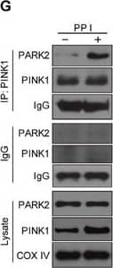 Western Blot: PINK1 Antibody - BSA Free [BC100-494] - Polyphyllin I triggers PINK1/PARK2-dependent mitophagyA. MDA-MB-231 cells were treated with 8 μM PPI for different periods of time as indicated, & PARK2, P62, & ubiquitin (UB) levels in mitochondrial fractions were determined by western blot. B. Cells were cotransfected with GFP-UB & RFP-mito & treated with 8 μM PPI for 9 h, after which PARK2 (Alexa Fluor 405, pink) & P62 (Alexa Fluor 647, blue) immunostaining was detected using confocal microscopy. C. Cells cotransfected with GFP-UB & RFP-LC3 were treated with 8 μM PPI for 9 h, after which PARK2 (Alexa Fluor 405, pink) & TOMM20 (Alexa Fluor 647, blue) immunostaining was detected using confocal microscopy. Scale bars: 10 μm. D-E. MDA-MB-231 cells were treated with 8 μM PPI for different periods of time as indicated; whole-cell lysates were then separated on 8% SDS-PAGE gels & analyzed by western blot using the anti-PINK1 antibody. Relative full-length (∼63 kDa) & cleaved (∼52 kDa) PINK1 levels were quantified by densitometry & normalized to Tubulin. The results were expressed as a percentage of control, which was set at 100%. Data are presented as mean ± SD (*P< 0.01 vs. the control). F. Cells were treated with 8 μM PPI for different periods of time as indicated, & whole-cell lysates were then subjected to western blot analysis. G. Cells were treated with 8 μM PPI for 9 h, after which mitochondrial fractions were prepared & subjected to immunoprecipitation using anti-PINK1 antibody; associated PARK2 was detected using immunoblotting. H. RFP-mito-expressing MDA-MB-231 cells were treated with 8 μM PPI for 9 h, & PINK1 (Alexa Fluor 488, green) & PARK2 (Alexa Fluor 405, pink) immunostaining were evaluated using confocal microscopy. Scale bars: 10 μm. Image collected & cropped by CiteAb from the following publication (//www.oncotarget.com/lookup/doi/10.18632/oncotarget.14413), licensed under a CC-BY license. Not internally tested by Novus Biologicals.