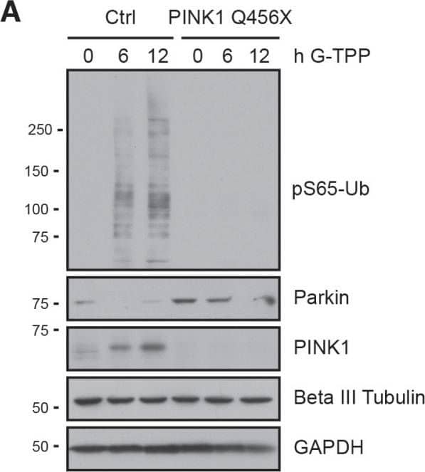 Western Blot: PINK1 Antibody - BSA Free [BC100-494] - G-TPP triggers PINK1 activation in iNeurons(A) Control cells or PINK1 Q456X fibroblasts were converted to induced neurons (iNeurons). Cells were treated for the indicated times with 10 µM G-TPP & harvested. Western blots were prepared & probed with antibodies against PINK1, pS65-Ub & Parkin. Beta III tubulin served as a control for successful conversion to neuronal cells, GAPDH as a loading control. (B) iNeurons were treated with 15 µM G-TPP for 8 h & fixed. Cells were stained with antibodies against pS65-Ub (green) & the mitochondrial marker TOM20 (red) & the neuronal marker Beta III tubulin (cyan). Nuclei were stained with Hoechst 33342 (blue). Scale bars correspond to 10 µM. A magnified image of the boxed region & the fluorescence profile along the arrow are shown to the right. Image collected & cropped by CiteAb from the following publication (//www.oncotarget.com/lookup/doi/10.18632/oncotarget.22287), licensed under a CC-BY license. Not internally tested by Novus Biologicals.