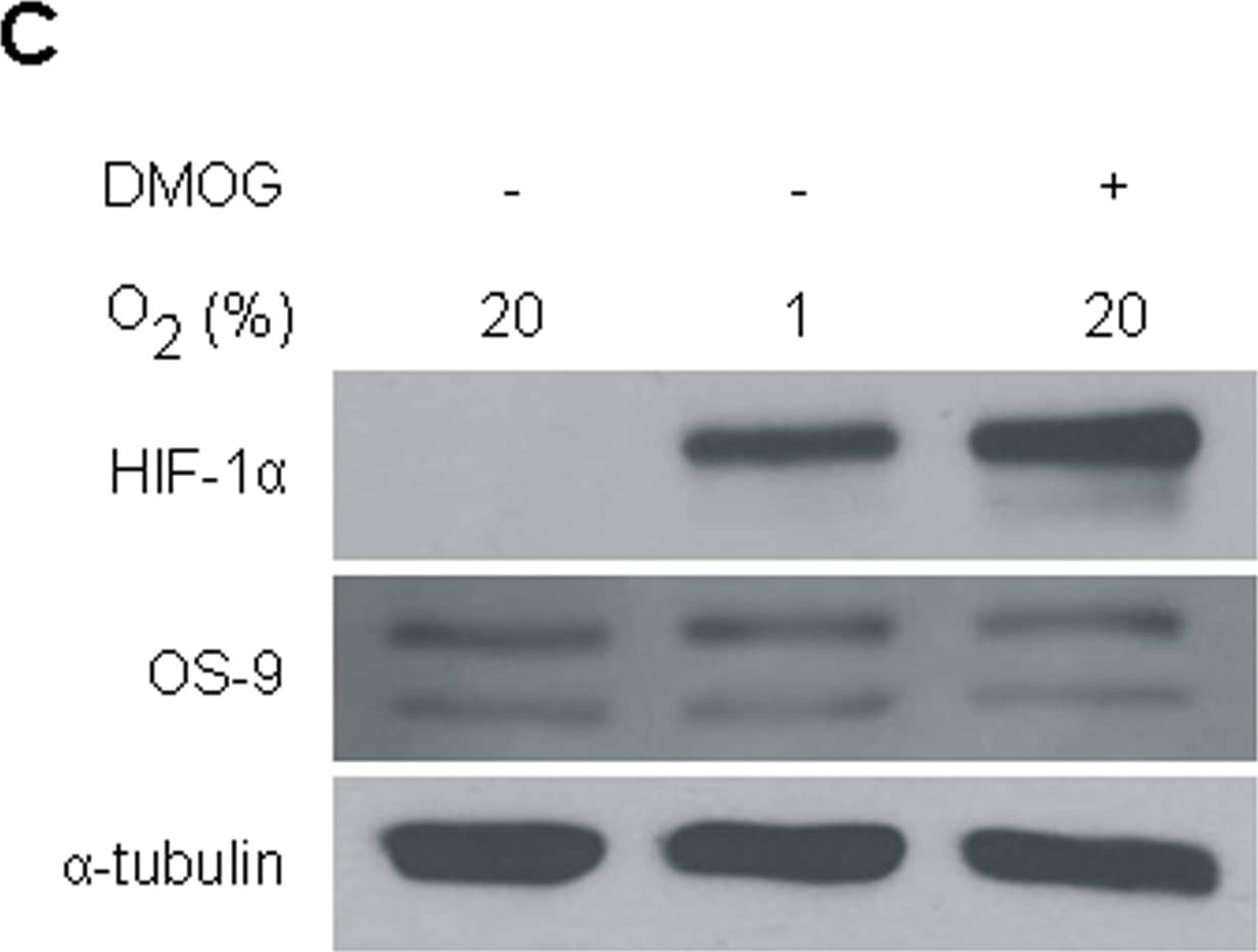 Western Blot: OS9 Antibody [BC100-520] - Initial characterization of the OS-9 protein.(A) OS-9 expression in various human cell lines. Equal protein amounts of total cell lysates were used for SDS-PAGE & subsequent Western blotting. For each cell line, two independent samples are shown. Endogenous OS-9 was detected with a polyclonal antibody raised against a peptide corresponding to amino acids 600–667 of isoform 1 of OS-9. (B) Protein stability assay of endogenous OS-9. U2OS cells were treated with the translational inhibitor cycloheximide (100 µM). At indicated time points, whole cell lysates were analysed by immunoblotting. (C) Effect of hypoxia on OS-9 expression. For hypoxia, UT-7 cells were exposed to 1% O2 for 24 h prior to Western blot analysis. To determine any influence of HIF-1 alpha  on OS-9 expression under normoxia, cells were incubated with the prolyl hydroxylase inhibitor DMOG (0.5 mM) for 24 h. (D) Protein interaction between OS-9 & PHD2 in vitro. For co-immunoprecipitation, U2OS cells were transiently co-transfected with the plasmids pOS-9-V5 & pPHD2-His, lysed in NP40 buffer, & subjected to immunoisolation with anti-V5 antibody recognizing OS-9 by its V5-tag. OS-9 & its associated proteins were separated by SDS-PAGE & analyzed by Western blot (lane 2). As controls, samples of untransfected (lane 1) cells or cells transfected with a single plasmid (lanes 3–4) were loaded. Representative Western blots are shown for each subfigure. Image collected & cropped by CiteAb from the following publication (//pubmed.ncbi.nlm.nih.gov/21559462), licensed under a CC-BY license. Not internally tested by Novus Biologicals.