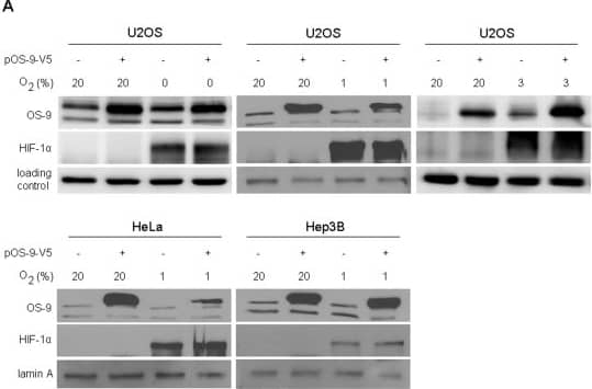 Western Blot: OS9 Antibody [BC100-520] - OS-9 shows no effect on regulation of HIF-1 alpha .Total cell lysates were used for SDS-PAGE & subsequent Western blotting. To generate nearly anoxic conditions, cells were exposed to an oxygen consuming chemical system or to 1% or 3% O2 for 4 h to generate hypoxia. (A) U2OS, HeLa & Hep3B cells were transiently transfected with the plasmid pOS-9-V5 48 h prior to the experiment. Lamin A & actin were used as loading controls. (B) U2OS cells were subjected to ER stress by incubation either with tunicamycin (1 µg/ml) or thapsigargin (0.5 µg/ml) for 20 h. To detect HIF-1 alpha  under normoxia, cells were treated with DMOG (1 mM) for 4 h. A sample of DMSO-only treated cells was loaded to exclude unspecific side effects of the solvent. (C) U2OS cells were transduced with lentiviral construct pLKO.1-shRNA-OS-9 (shOS-9) mediating a stable knockdown of OS-9 expression. Control cells (c) were transduced with plasmid pLKO.1-puro. Representative Western blots are shown for each subfigure. Image collected & cropped by CiteAb from the following publication (//pubmed.ncbi.nlm.nih.gov/21559462), licensed under a CC-BY license. Not internally tested by Novus Biologicals.