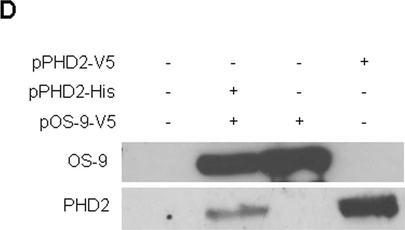 Western Blot: OS9 Antibody [BC100-520] - Initial characterization of the OS-9 protein.(A) OS-9 expression in various human cell lines. Equal protein amounts of total cell lysates were used for SDS-PAGE & subsequent Western blotting. For each cell line, two independent samples are shown. Endogenous OS-9 was detected with a polyclonal antibody raised against a peptide corresponding to amino acids 600–667 of isoform 1 of OS-9. (B) Protein stability assay of endogenous OS-9. U2OS cells were treated with the translational inhibitor cycloheximide (100 µM). At indicated time points, whole cell lysates were analysed by immunoblotting. (C) Effect of hypoxia on OS-9 expression. For hypoxia, UT-7 cells were exposed to 1% O2 for 24 h prior to Western blot analysis. To determine any influence of HIF-1 alpha  on OS-9 expression under normoxia, cells were incubated with the prolyl hydroxylase inhibitor DMOG (0.5 mM) for 24 h. (D) Protein interaction between OS-9 & PHD2 in vitro. For co-immunoprecipitation, U2OS cells were transiently co-transfected with the plasmids pOS-9-V5 & pPHD2-His, lysed in NP40 buffer, & subjected to immunoisolation with anti-V5 antibody recognizing OS-9 by its V5-tag. OS-9 & its associated proteins were separated by SDS-PAGE & analyzed by Western blot (lane 2). As controls, samples of untransfected (lane 1) cells or cells transfected with a single plasmid (lanes 3–4) were loaded. Representative Western blots are shown for each subfigure. Image collected & cropped by CiteAb from the following publication (//pubmed.ncbi.nlm.nih.gov/21559462), licensed under a CC-BY license. Not internally tested by Novus Biologicals.