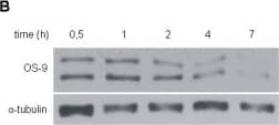 Western Blot: OS9 Antibody [BC100-520] - Initial characterization of the OS-9 protein.(A) OS-9 expression in various human cell lines. Equal protein amounts of total cell lysates were used for SDS-PAGE & subsequent Western blotting. For each cell line, two independent samples are shown. Endogenous OS-9 was detected with a polyclonal antibody raised against a peptide corresponding to amino acids 600–667 of isoform 1 of OS-9. (B) Protein stability assay of endogenous OS-9. U2OS cells were treated with the translational inhibitor cycloheximide (100 µM). At indicated time points, whole cell lysates were analysed by immunoblotting. (C) Effect of hypoxia on OS-9 expression. For hypoxia, UT-7 cells were exposed to 1% O2 for 24 h prior to Western blot analysis. To determine any influence of HIF-1 alpha  on OS-9 expression under normoxia, cells were incubated with the prolyl hydroxylase inhibitor DMOG (0.5 mM) for 24 h. (D) Protein interaction between OS-9 & PHD2 in vitro. For co-immunoprecipitation, U2OS cells were transiently co-transfected with the plasmids pOS-9-V5 & pPHD2-His, lysed in NP40 buffer, & subjected to immunoisolation with anti-V5 antibody recognizing OS-9 by its V5-tag. OS-9 & its associated proteins were separated by SDS-PAGE & analyzed by Western blot (lane 2). As controls, samples of untransfected (lane 1) cells or cells transfected with a single plasmid (lanes 3–4) were loaded. Representative Western blots are shown for each subfigure. Image collected & cropped by CiteAb from the following publication (//pubmed.ncbi.nlm.nih.gov/21559462), licensed under a CC-BY license. Not internally tested by Novus Biologicals.