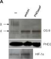 Western Blot: OS9 Antibody [BC100-520] - Cellular localization of OS-9 & PHD2.(A) A lectin gel-shift assay was conducted to test for glycosylated proteins. Total cell lysates of U2OS cells were incubated in the presence or absence of the endoglycosidases EndoH & PNGaseF for 6 h at 37°C. Digest products were separated on a reducing 10% SDS-PAGE gel which contained concanavalin A co-polymerized in the top layer of the separating gel to retard mobility of glycosylated proteins [56]. Glycosylated OS-9 is indicated as ‘g’, deglycosylated OS-9 as ‘d’. (B) Detection of OS-9 & PHD2 in the nuclear fraction. HEK293 cells with & without transfection of the plasmid pcDNA3-OS-9 were separated into nuclear fraction (N) & postnuclear supernatant (PS), the latter containing cytoplasm & organelles. Western blot analysis included BiP, GAPDH & lamin A as typical marker proteins for the ER, the cytoplasm & the nucleus, respectively. (C) Detection of OS-9 & PHD2 in the cytoplasm. HEK293 cells were co-transfected with pcDNA3-OS-9 & pPHD2-V5. For hypoxia, cells were exposed to 3% O2 for 4 h. Cells were treated with 50 µg/ml digitonin & centrifuged to obtain a cytoplasmic (C) & an organelle fraction (O) & subjected to immunoblotting. (D) Isolation of cellular endomembranes. HEK293 cells were lysed mechanically by several passages through a 30½G needle. The postnuclear supernatant was processed further by ultra-centrifugation to separate the organelles (O) from the cytosol (C). High salt treatment (1 M KCl) of the organelle fraction produced a wash fraction (W) that contained dissociated peripheral membrane proteins. For immunoblot analysis of subcellular fractionations, cell aliquots were normalized for cell number prior to loading (B–D). Representative Western blots are shown for each subfigure. Image collected & cropped by CiteAb from the following publication (//pubmed.ncbi.nlm.nih.gov/21559462), licensed under a CC-BY license. Not internally tested by Novus Biologicals.