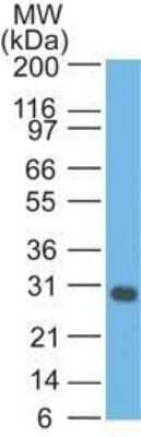 Western Blot: bcl-x Antibody (BX006 + 2H12) [NBP2-34290] - Western blot analysis of Jurkat Cell lysate using bcl-X MAb (BX006 + 2H12).