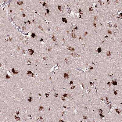 Immunohistochemistry-Paraffin: bcl10-interacting CARD protein Antibody [NBP1-88777] - Staining of human cerebral cortex shows strong cytoplasmic positivity in neuronal cells.