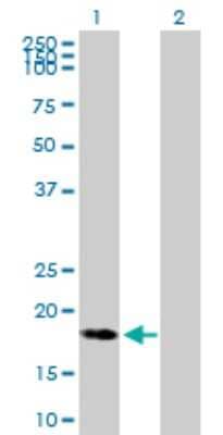 Western Blot: bcl10-interacting CARD protein Antibody [H00084270-B01P] - Analysis of C9orf89 expression in transfected 293T cell line by C9orf89 polyclonal antibody.  Lane 1: C9orf89 transfected lysate(20.13 KDa). Lane 2: Non-transfected lysate.