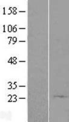 Western Blot: bcl10-interacting CARD protein Overexpression Lysate (Adult Normal) [NBL1-08606] Left-Empty vector transfected control cell lysate (HEK293 cell lysate); Right -Over-expression Lysate for bcl10-interacting CARD protein.