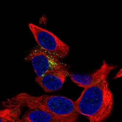 Immunocytochemistry/Immunofluorescence: beta-1,3-Glucuronyltransferase 1/B3GAT1 Antibody [NBP2-57597] - Staining of human cell line SH-SY5Y shows localization to vesicles.