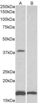 Western Blot: beta-1,3-Glucuronyltransferase 1/B3GAT1 Antibody [NBP2-26184] - Staining of Human Frontal Cortex lysate (35 ug protein in RIPA buffer) with (B) and without (A) blocking with the immunizing peptide. Primary incubation was 1 hour. Detected by chemiluminescence.  