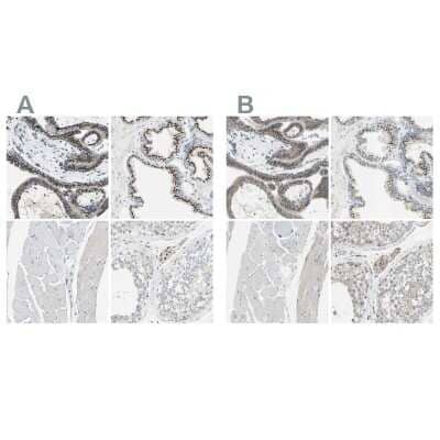 Immunohistochemistry-Paraffin beta-1,4-Galactosyltransferase 1/B4GalT1 Antibody