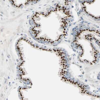 Immunohistochemistry-Paraffin: beta-1,4-Galactosyltransferase 1/B4GalT1 Antibody [NBP1-88654] - Staining of human prostate shows strong granular cytoplasmic positivity in glandular cells.