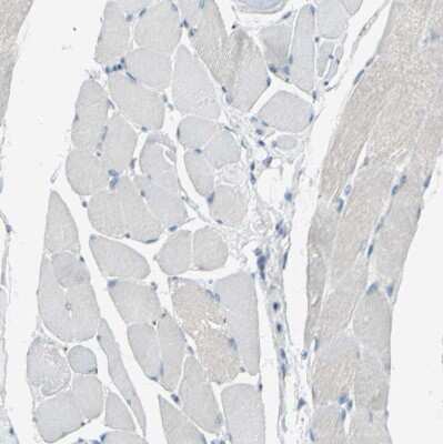 Immunohistochemistry-Paraffin: beta-1,4-Galactosyltransferase 1/B4GalT1 Antibody [NBP1-88654] - Staining of human skeletal muscle shows no positivity in myocytes as expected.