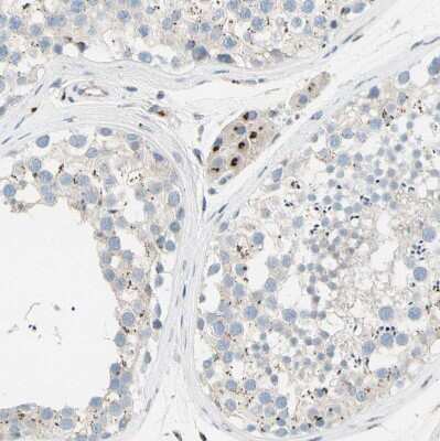 Immunohistochemistry-Paraffin: beta-1,4-Galactosyltransferase 1/B4GalT1 Antibody [NBP1-88654] - Staining of human testis shows strong granular cytoplasmic positivity in Leydig cells.