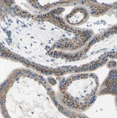 Immunohistochemistry-Paraffin: beta-1,4-Galactosyltransferase 1/B4GalT1 Antibody [NBP1-88655] - Staining of human placenta shows strong granular cytoplasmic positivity in trophoblastic cells.