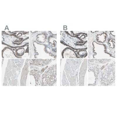 Immunohistochemistry-Paraffin: beta-1,4-Galactosyltransferase 1/B4GalT1 Antibody [NBP1-88655] - Staining of human placenta, prostate, skeletal muscle and testis using Anti-B4GALT1 antibody NBP1-88655 (A) shows similar protein distribution across tissues to independent antibody NBP1-88654 (B).