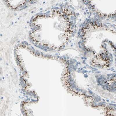 Immunohistochemistry-Paraffin: beta-1,4-Galactosyltransferase 1/B4GalT1 Antibody [NBP1-88655] - Staining of human prostate shows strong granular cytoplasmic positivity in glandular cells.