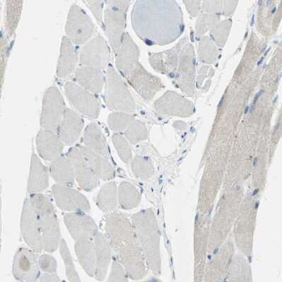 Immunohistochemistry-Paraffin: beta-1,4-Galactosyltransferase 1/B4GalT1 Antibody [NBP1-88655] - Staining of human skeletal muscle shows no positivity in myocytes as expected.